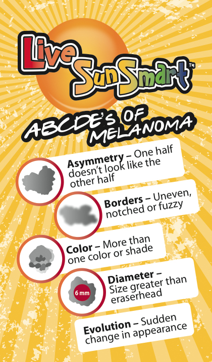 Live Sun Smart - ABCDE's of Melanoma. A = Asymmetry - one half doesn't look like the other half. B = Borders - uneven, notched or fuzzy. C = Color - more than one color or shade. D = Diameter - Size greater than an eraserhead. E = Evolution - Sudden change in appearance.  